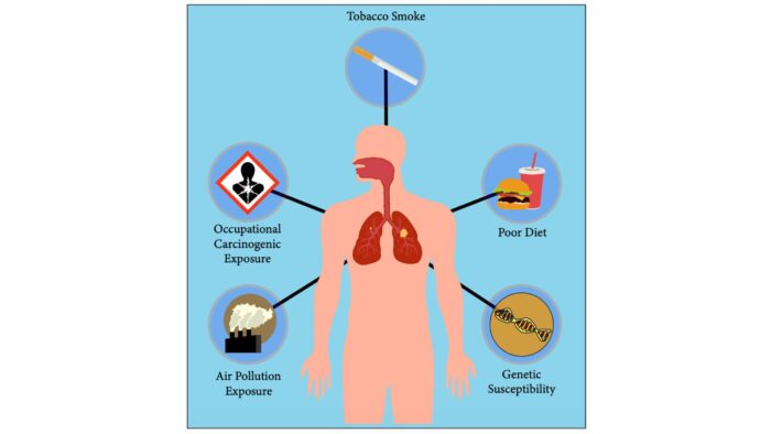 Risk Factors for Non-Small Cell Lung Cancer NSCLC