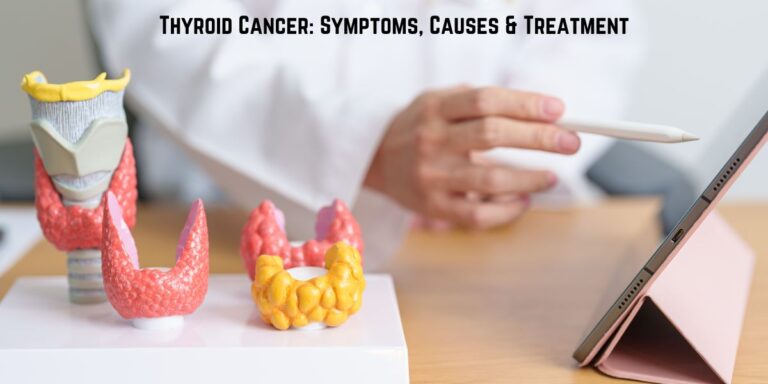 Thyroid Cancer