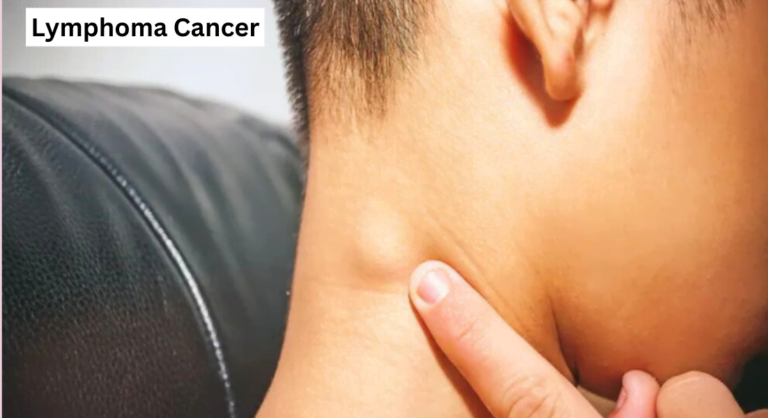 Lymphoma