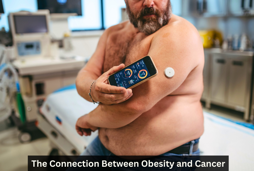 The Connection Between Obesity and Cancer