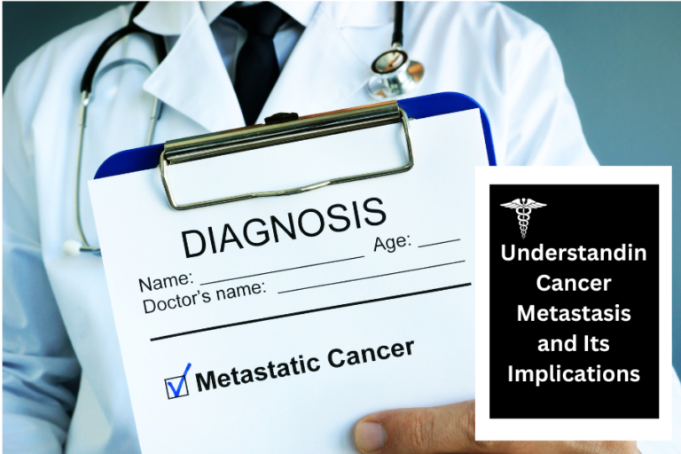 Understanding Cancer Metastasis and Its Implications
