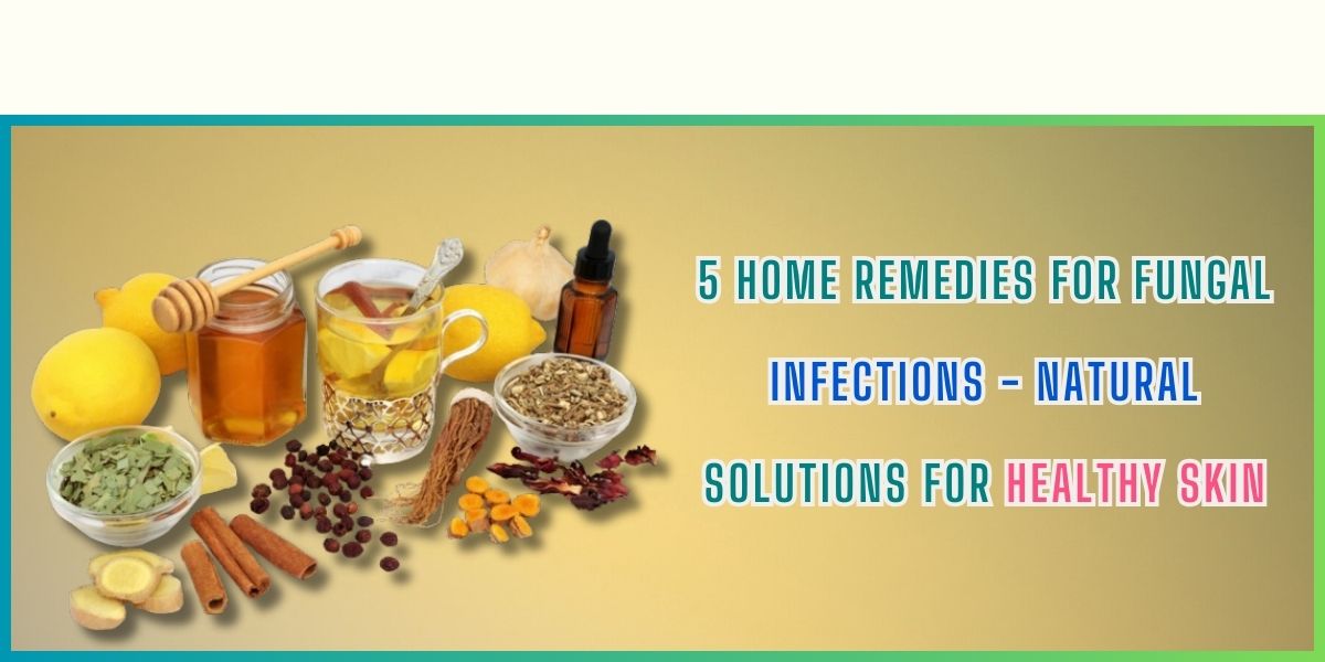 5 Home Remedies for Fungal Infections Natural Solutions for Healthy Skin