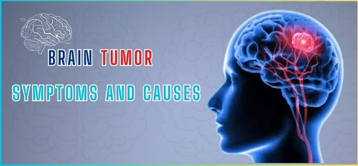 ब्रेन ट्यूमर: कारण, लक्षण, उपचार और बचाव के तरीके