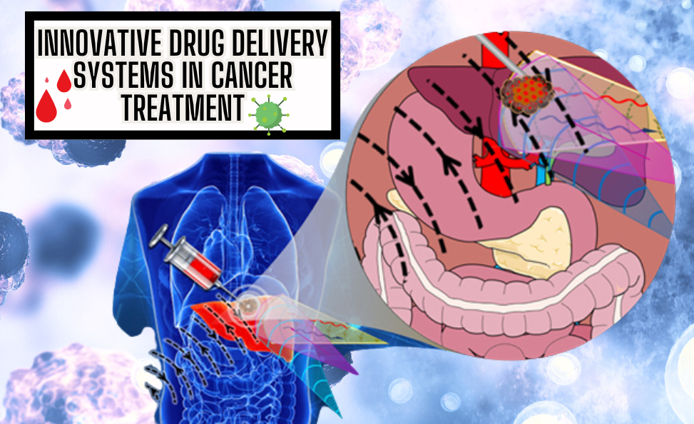 Innovative Drug Delivery Systems in Cancer Treatment